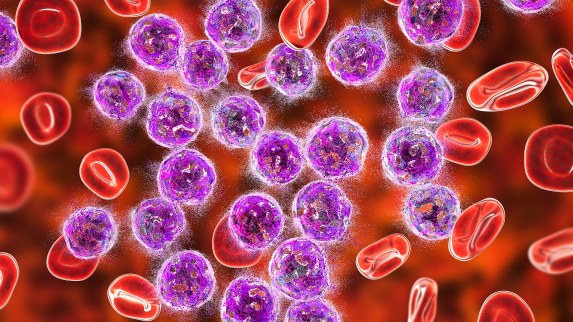 Scientists Discover How Leukemia Cells Evade Treatment.