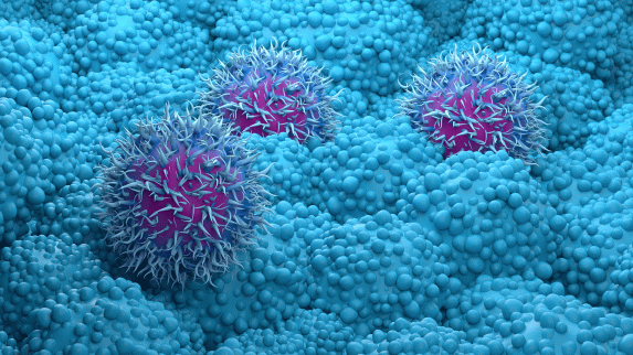 Researchers Uncover Triple Immunotherapy Combination as Potential Treatment for Pancreatic Cancer.
