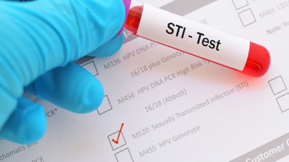 Study Backs Four-Step Plan for Detecting More Sexually Transmitted Infections.